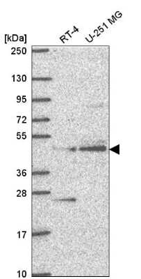 Western Blot: AGXT2L1 Antibody [NBP2-57397]