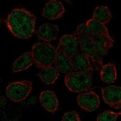 Immunocytochemistry/ Immunofluorescence: AHDC1 Antibody [NBP3-17335]