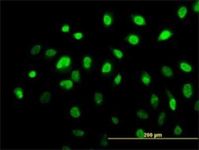 Immunocytochemistry/ Immunofluorescence: AHR Antibody (3B12) [H00000196-M02]