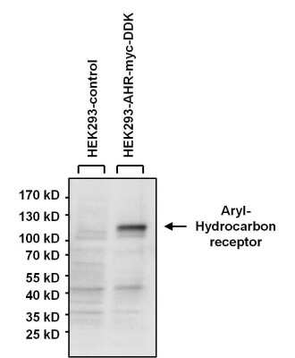 Western Blot: AHR Antibody (RPT1) [NB300-530]