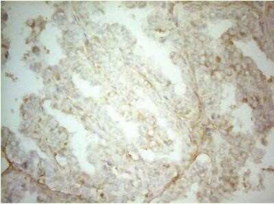 Immunohistochemistry: AHSA1 Antibody (OTI1D2) - Azide and BSA Free [NBP2-71608]
