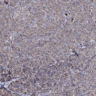 Immunohistochemistry-Paraffin: AIBZIP Antibody [NBP1-90205]
