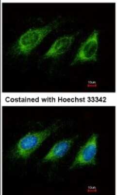 Immunocytochemistry/ Immunofluorescence: AICDA Antibody [NBP1-30955]