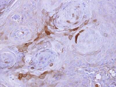 Immunohistochemistry-Paraffin: AICDA Antibody [NBP1-30955]