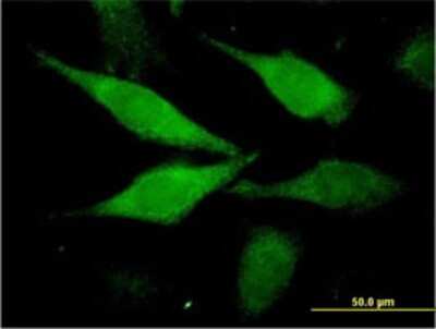Immunocytochemistry/ Immunofluorescence: AIDA Antibody (2E6-1C11) [H00064853-M01]