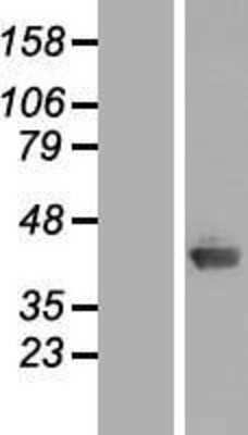 Western Blot: AIDA Overexpression Lysate [NBL1-07407]