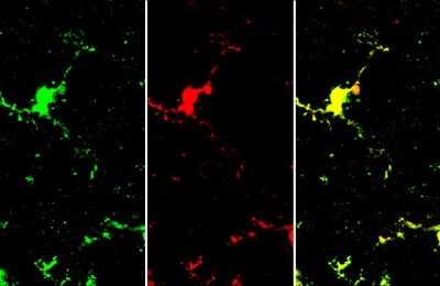 Immunohistochemistry-Frozen: AIF-1/Iba1 Antibody (HL22) [NBP3-13648]