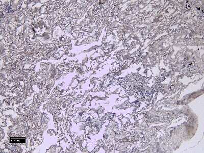 Immunohistochemistry-Paraffin: AIF-1/Iba1 Antibody [NB100-2833]