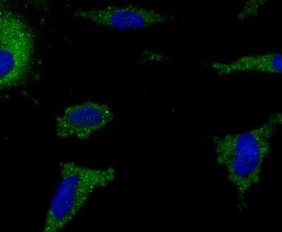 Immunocytochemistry/ Immunofluorescence: AIF-1/Iba1 Antibody (JM36-62) [NBP2-75397]