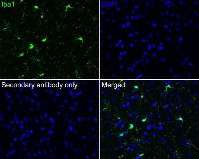Immunohistochemistry-Paraffin: AIF-1/Iba1 Antibody (JM36-62) [NBP2-75397]