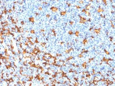 Immunohistochemistry-Paraffin: AIF-1/Iba1 Antibody (rAIF1/1909) - Azide and BSA Free [NBP2-75760]