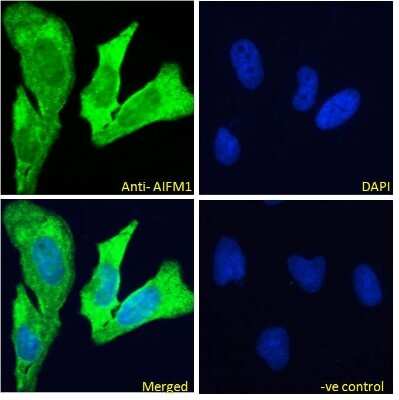 Immunocytochemistry/ Immunofluorescence: AIF Antibody [NBP2-42496]