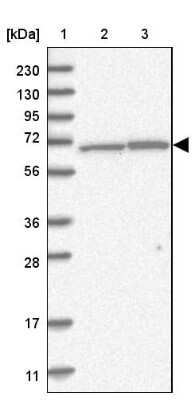 Western Blot: AIF Antibody [NBP2-33932]