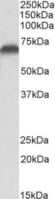 Western Blot: AIF Antibody [NBP2-42509]