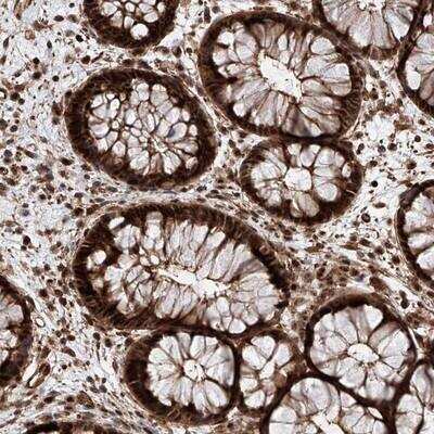 Immunohistochemistry: AIM1L Antibody [NBP1-90617]
