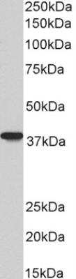 Western Blot: AIM2 Antibody (10M2B3) [NBP2-27355]