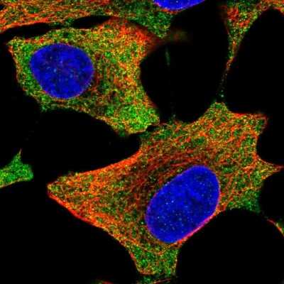 Immunocytochemistry/ Immunofluorescence: AIMP2 Antibody [NBP1-81575]