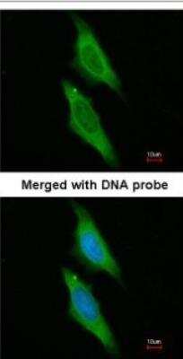 Immunocytochemistry/ Immunofluorescence: AIP/ARA9 Antibody [NBP1-31347]