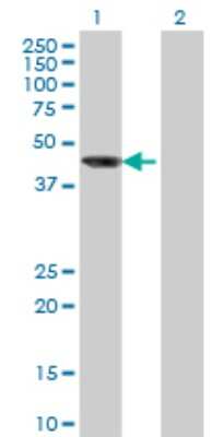 Western Blot: AIPL1 Antibody (1E1) [H00023746-M04]