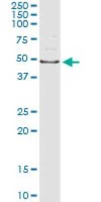 Immunoprecipitation: AIPL1 Antibody (3A3) [H00023746-M23]