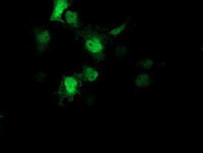 Immunocytochemistry/ Immunofluorescence: AIPL1 Antibody (OTI3B4) [NBP2-01327]