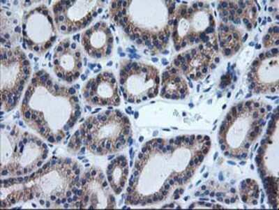 Immunohistochemistry-Paraffin: AIPL1 Antibody (OTI3B4) [NBP2-01327]