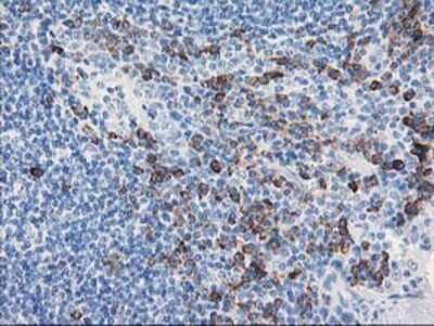 Immunohistochemistry: AIPL1 Antibody (OTI3B4) - Azide and BSA Free [NBP2-71775]