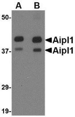 Western Blot: AIPL1 AntibodyBSA Free [NBP1-76956]
