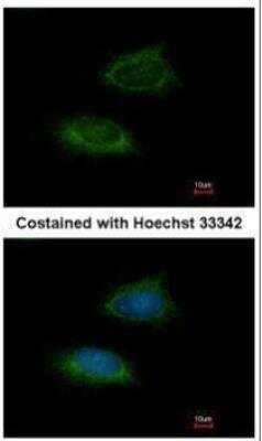 Immunocytochemistry/ Immunofluorescence: AK2 Antibody [NBP1-33160]
