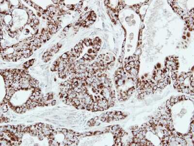 Immunohistochemistry-Paraffin: AK2 Antibody [NBP1-33160]
