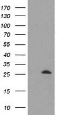 Western Blot: AK3 Antibody (OTI6G4)Azide and BSA Free [NBP2-71874]