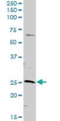 Western Blot: AK3 Antibody [H00050808-D01P]
