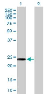 Western Blot: AK3 Antibody [H00050808-D01P]