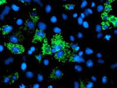 Immunocytochemistry/ Immunofluorescence: AK3L1 Antibody (OTI3B1) [NBP2-00827]