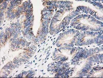 Immunohistochemistry-Paraffin: AK3L1 Antibody (OTI3B1) [NBP2-00827]