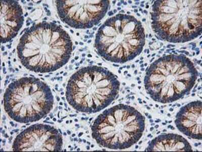 Immunohistochemistry-Paraffin: AK3L1 Antibody (OTI3B1) [NBP2-00827]