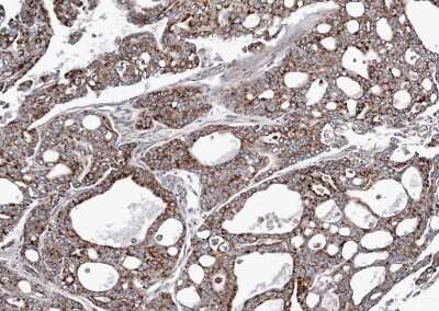 Immunohistochemistry-Paraffin: AK3L1 Antibody [NBP1-31462]