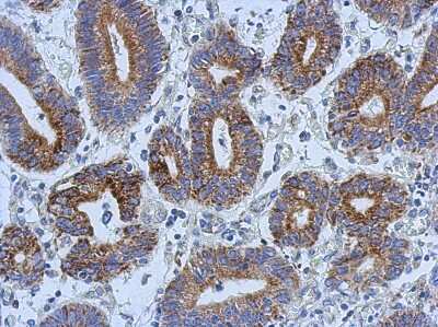 Immunohistochemistry-Paraffin: AK3L1 Antibody [NBP2-15317]