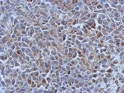 Immunohistochemistry-Paraffin: AK3L1 Antibody [NBP2-15317]