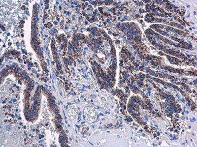 Immunohistochemistry-Paraffin: AK3L1 Antibody [NBP2-15317]