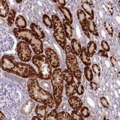 Immunohistochemistry-Paraffin: AK3L1 Antibody [NBP2-47553]