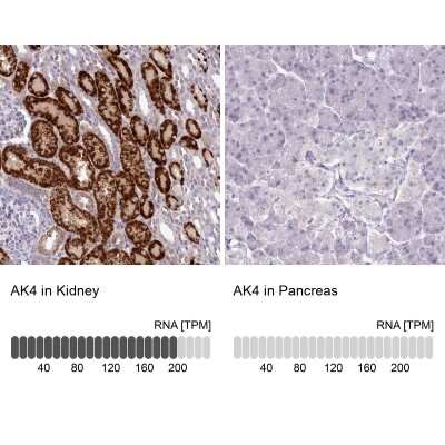 Immunohistochemistry-Paraffin: AK3L1 Antibody [NBP2-47553]