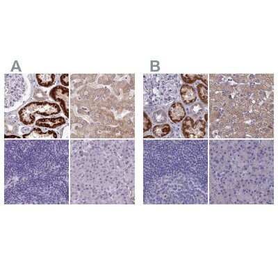 Immunohistochemistry-Paraffin: AK3L1 Antibody [NBP2-47553]