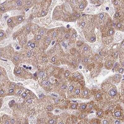 Immunohistochemistry-Paraffin: AK3L1 Antibody [NBP2-47553]