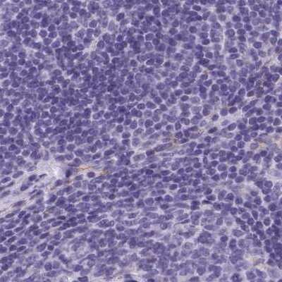 Immunohistochemistry-Paraffin: AK3L1 Antibody [NBP2-47553]