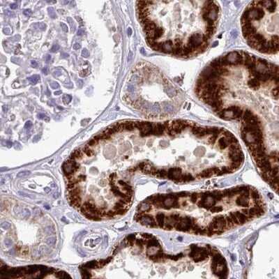 Immunohistochemistry-Paraffin: AK3L1 Antibody [NBP2-47553]