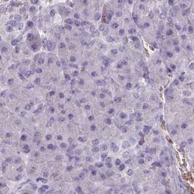Immunohistochemistry-Paraffin: AK3L1 Antibody [NBP2-47553]