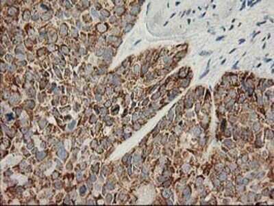 Immunohistochemistry: AK3L1 Antibody (OTI3B1) - Azide and BSA Free [NBP2-70129]