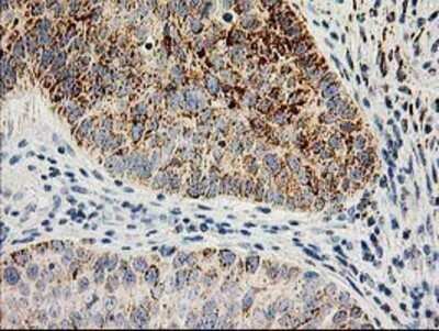 Immunohistochemistry: AK3L1 Antibody (OTI3B1) - Azide and BSA Free [NBP2-70129]
