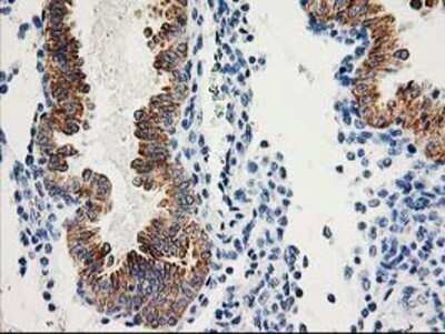 Immunohistochemistry: AK3L1 Antibody (OTI3B1) - Azide and BSA Free [NBP2-70129]